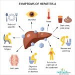 Pahami Penyebab Utama Hepatitis