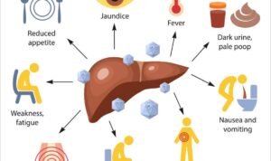 Pahami Penyebab Utama Hepatitis